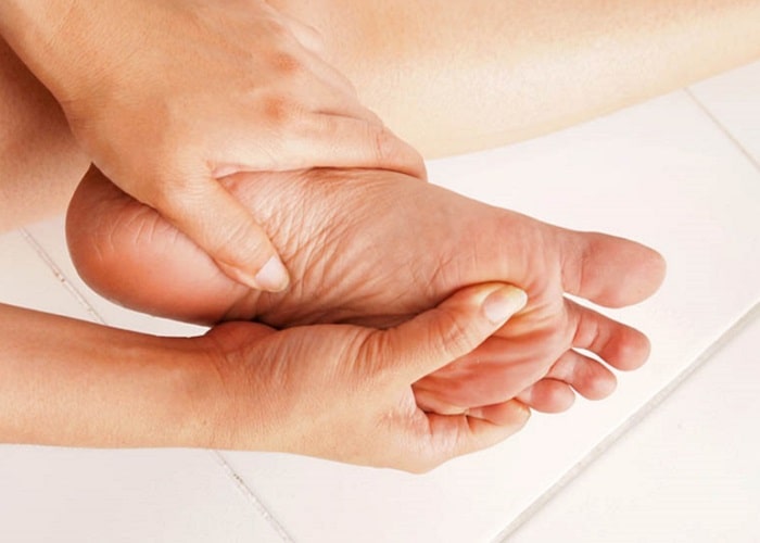درمان انواع قارچ پوستی پا و پیشگیری از ابتلا به قارچ پا